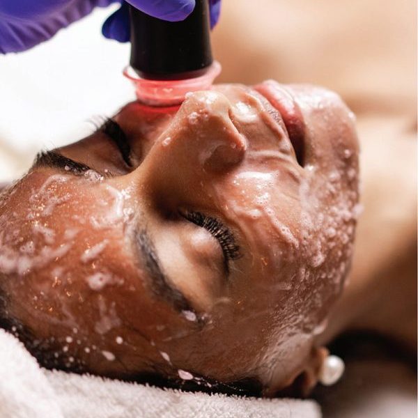 Oxygen Facial/Scrubbing